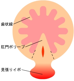 裂肛